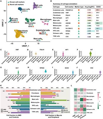 In-depth mining of single-cell transcriptome reveals the key immune-regulated loops in age-related macular degeneration
